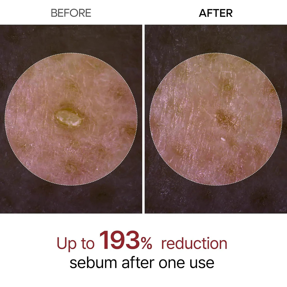 Jeloria Rice Peel Serum Ampoule™