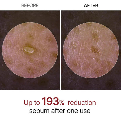 Jeloria Rice Peel Serum Ampoule™