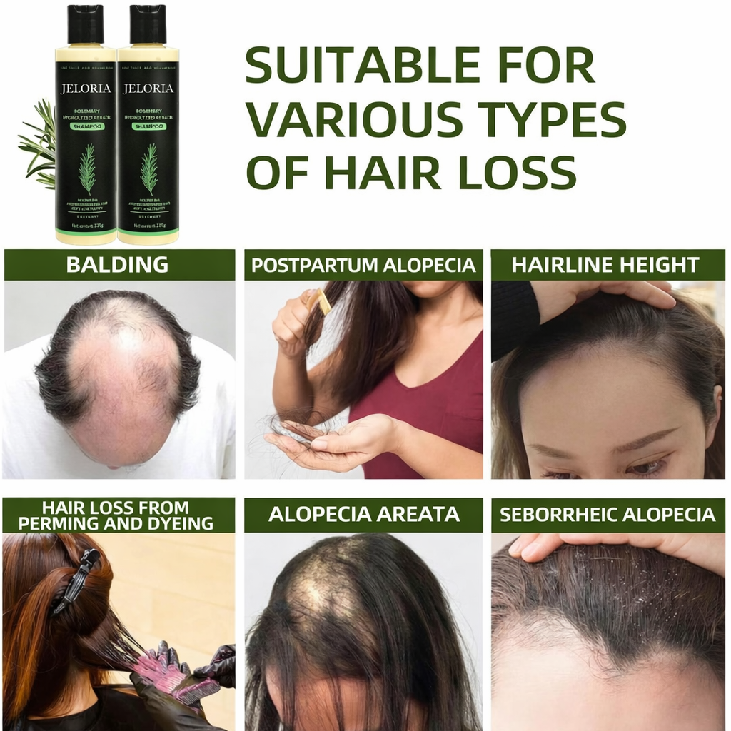 Organic Rosemary Hair Growth Shampoo